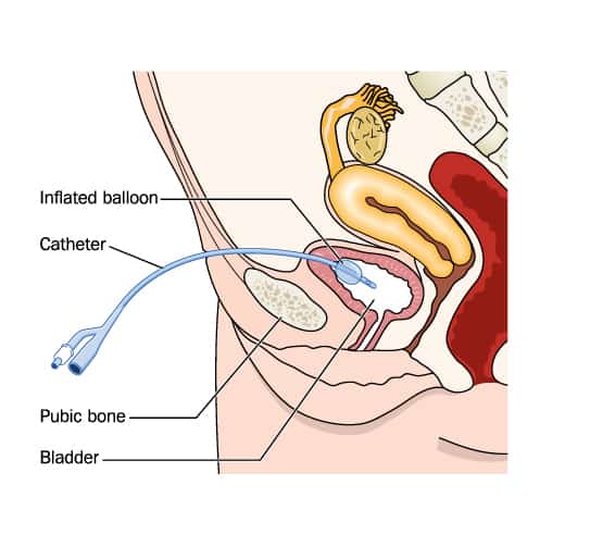 suprapubic area